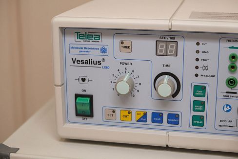 Удаление бородавок лазером