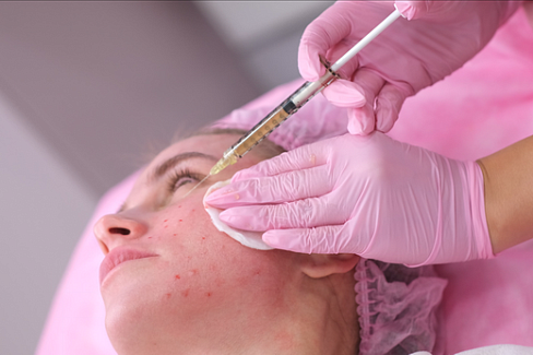 Методика плазмотерапии Cortexil