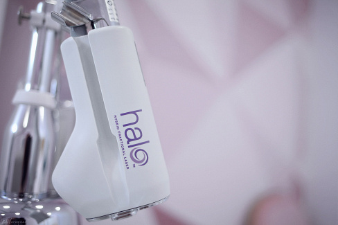 Фракционный лазер отшелушивает пигмент