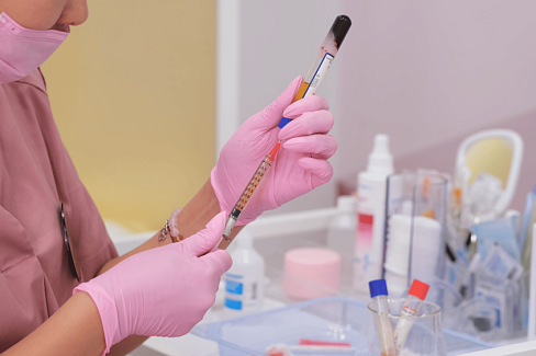 Процедура плазмолифтинга волосистой части